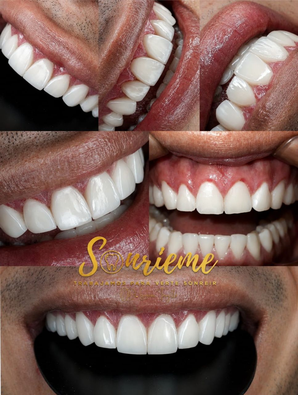 Sonrisas transformadas en Sonríeme