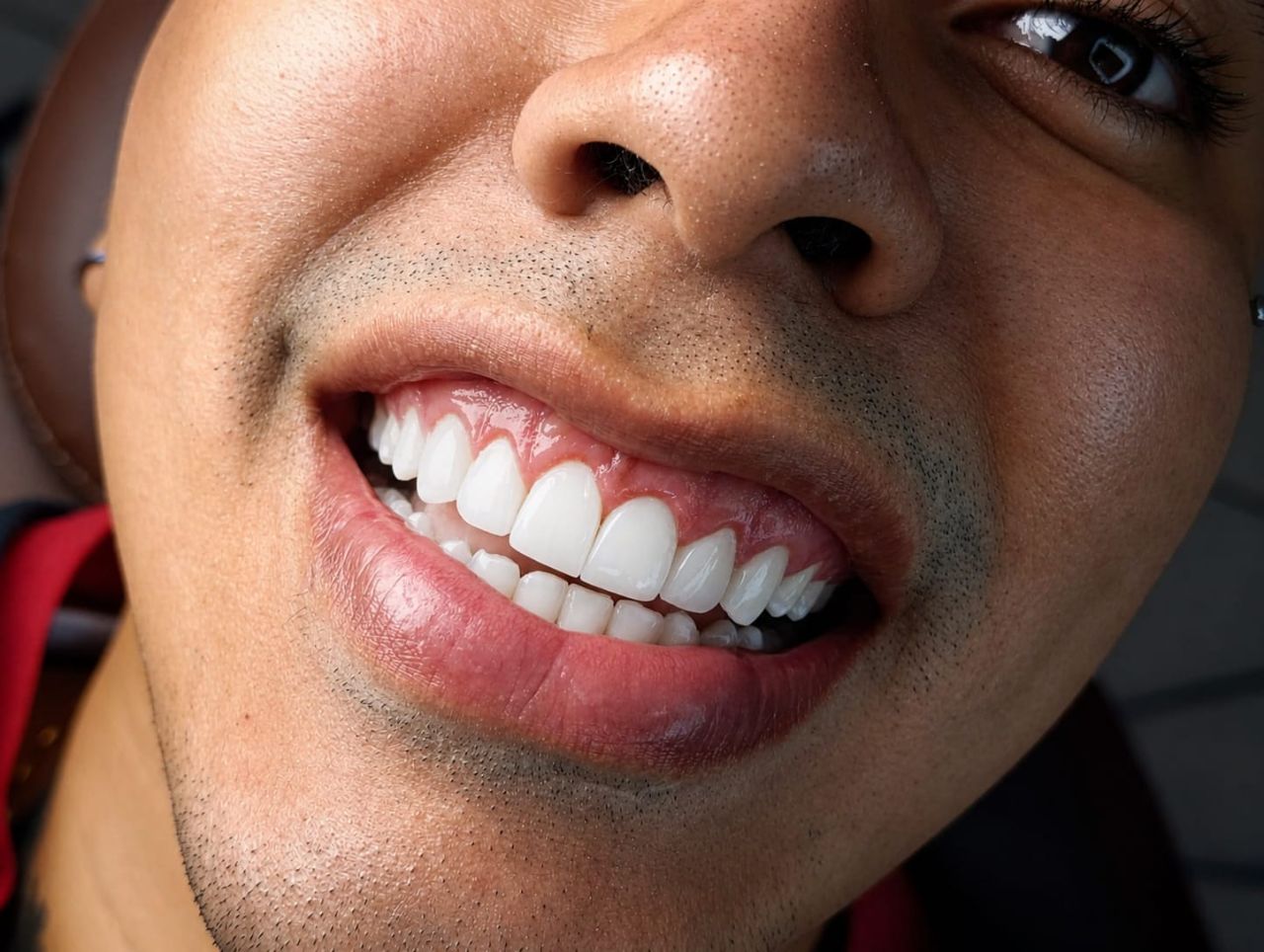 Diseño de Sonrisa
